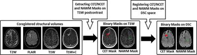 Effect of Applying Leakage Correction on rCBV Measurement Derived From DSC-MRI in Enhancing and Nonenhancing Glioma